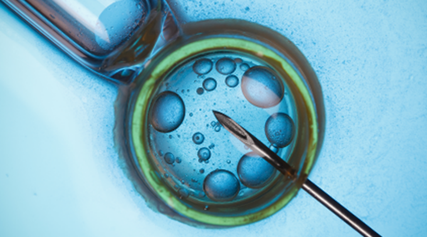 IVF Treatment
