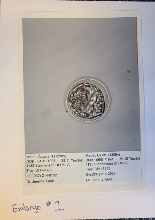 Martin IVF Journey