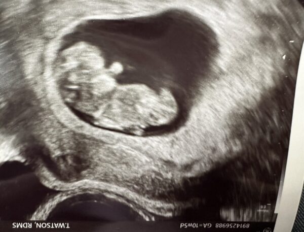 Help us with a 2nd chance after 14wk loss