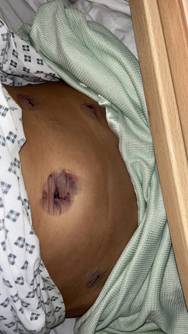 Nicole’s IVF journey