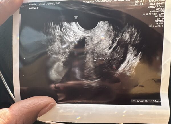 Infertility for 10 years