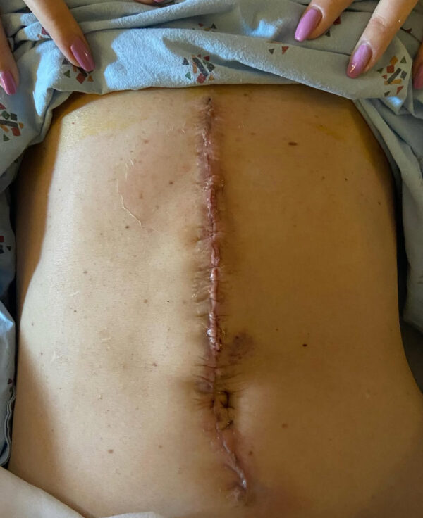 I fought cancer while he fought wars. Help our family fight for a baby