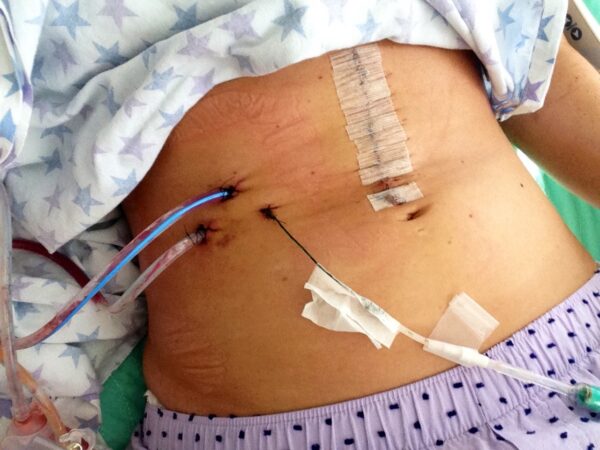 I fought cancer while he fought wars. Help our family fight for a baby