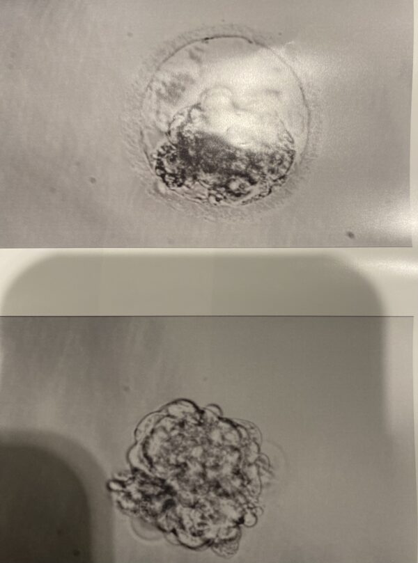 Embryo Transfer