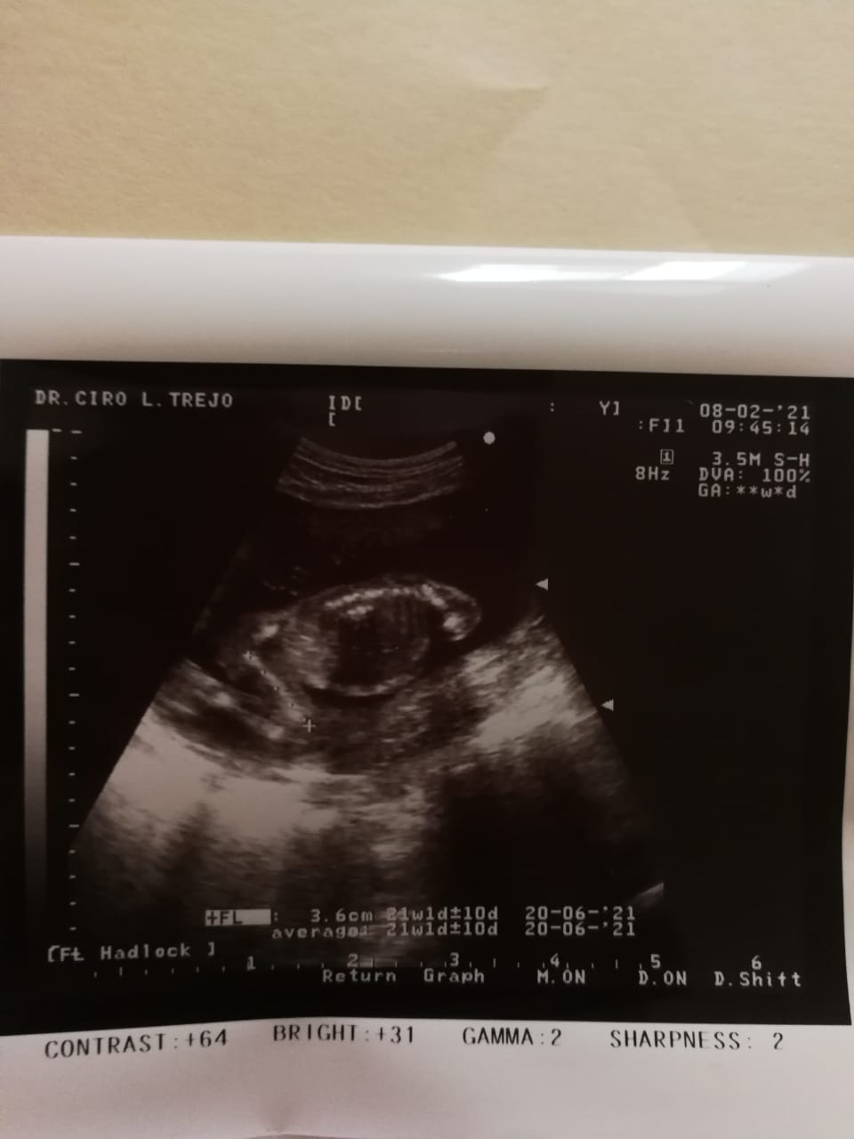 Faith for the love I need