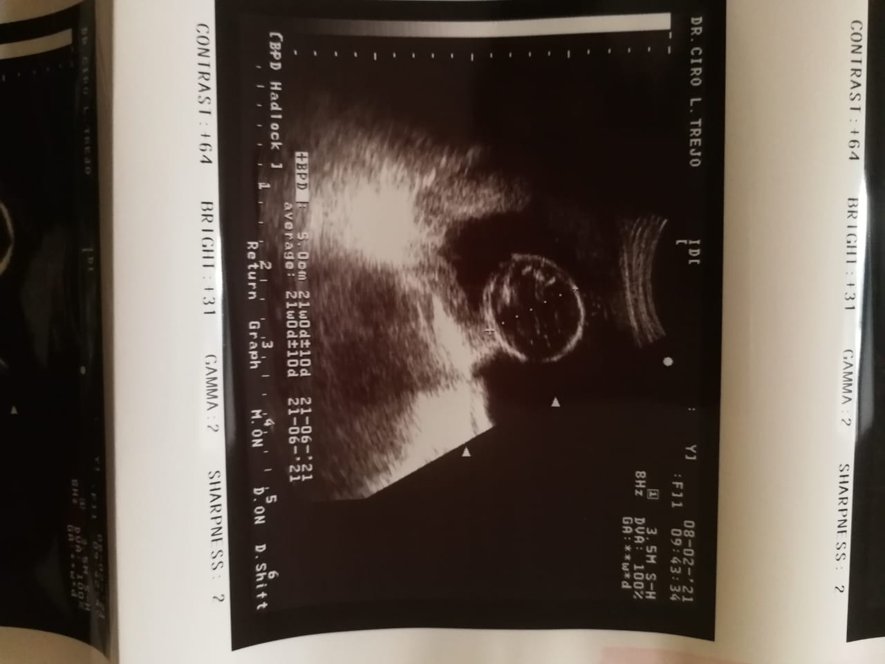 Faith for the love I need