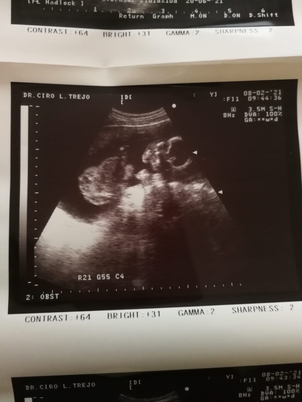 Faith for the love I need