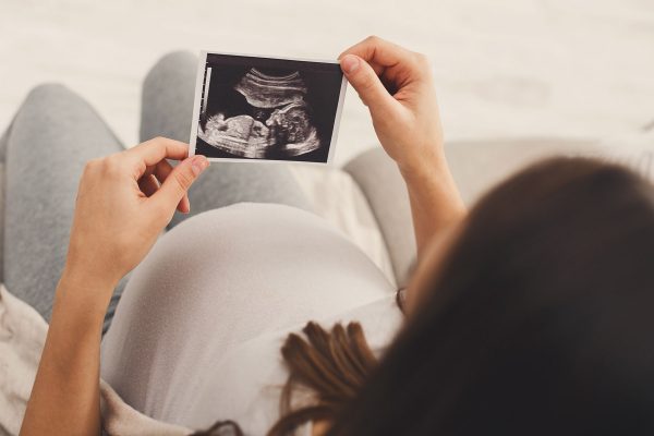 Pregnant woman looking at her baby sonography. Unrecognizable expectant lady enjoying first photo of her unborn child, anticipating her future life, copy space